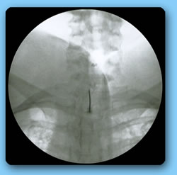 sdf
